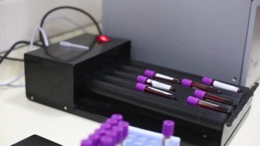 Analizli tıbbi test tüplerinin arka planında DNA testi olan bir test tüpü tutan doktor..