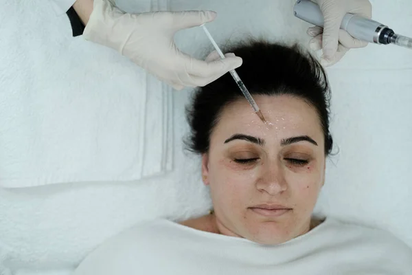 Kosmetolog Stosujący Serum Mezoterapeutyczne Przygotowanie Skóry Zabiegu Mikroigłowania Kaukaski — Zdjęcie stockowe
