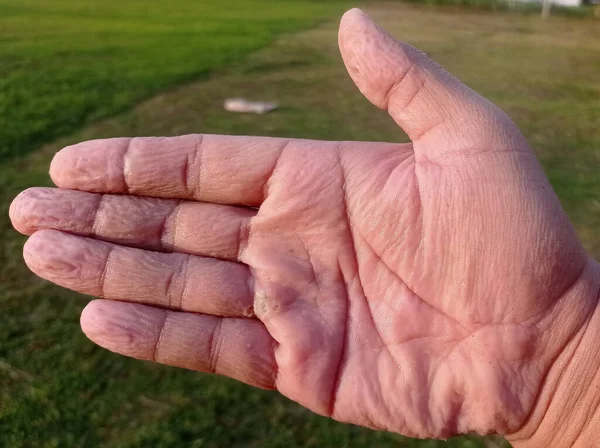 wrinkled finger a grown man after playing in water for too long
