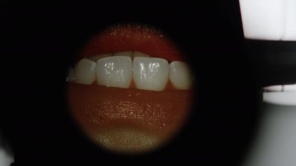 Стоматолог Осматривает Зубы Пациента Стоматологической Клиники Микроскопом — стоковое видео