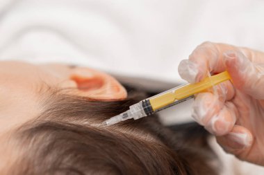 Güzellik uzmanları saç uzatmak için kafa derisine iğne yapar. Saç uzatmak için Mezoterapi ve kuaförde güçlendirmek için. Saç dökülmesine karşı bir prosedür.