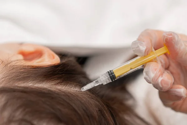 Kosmetik Dělá Injekce Pokožky Hlavy Pro Růst Vlasů Mezoterapie Pro — Stock fotografie