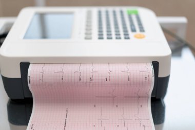 Bir kardiyolog hastanın kalp atışlarının ve nabzının analizini klinikte yapmak için EKG kardiyogramı yapar.