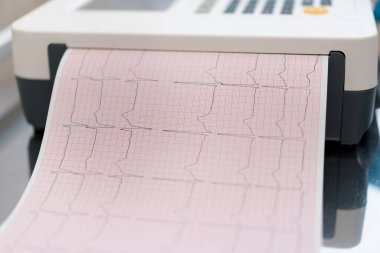Bir kardiyolog hastanın kalp atışlarının ve nabzının analizini klinikte yapmak için EKG kardiyogramı yapar.