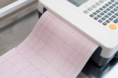 Bir kardiyolog hastanın kalp atışlarının ve nabzının analizini klinikte yapmak için EKG kardiyogramı yapar.