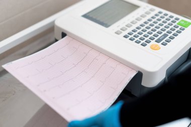 Bir kardiyolog hastanın kalp atışlarının ve nabzının analizini klinikte yapmak için EKG kardiyogramı yapar.