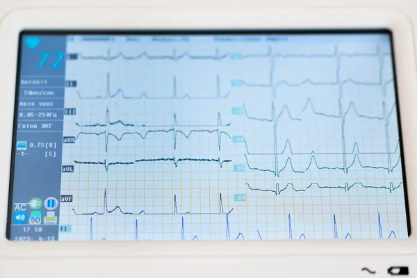 心臓科医は診療所の患者の心臓の心臓グラムの結果としてデジタルタブレットの画面を示しています — ストック写真