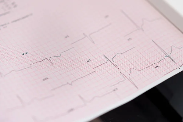 循環器内科医は患者の心電図を作成し患者の脈拍数と心拍の分析を診療所で印刷します — ストック写真