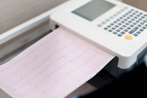 Cardiologist Makes Ecg Cardiogram Patient Prints Analysis Patient Pulse Rate — Stock Photo, Image