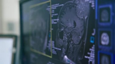 Beyin bilgisayarlı tomografi ile tümör 3 boyutlu görüntüleme ekranda insan vücudu araştırma kliniği