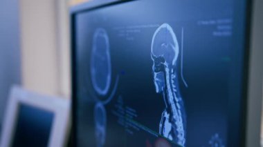 Beyin bilgisayarlı tomografi ile tümör 3 boyutlu görüntüleme ekranda insan vücudu araştırma kliniği
