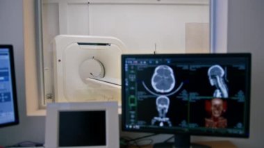 Tıbbi araştırma odasında tomografi görüntüsü olan bilgisayar tomografi ekipmanları klinik ekranında.