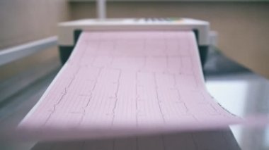 Bir kardiyolog hastanın kalp atışlarının ve nabzının analizini klinikte yapmak için EKG kardiyogramı yapar.