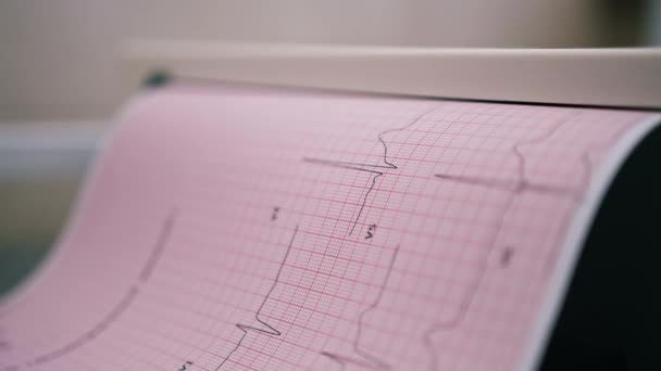 循環器内科医は患者の心電図を作成し患者の脈拍数と心拍の分析を診療所で印刷します — ストック動画