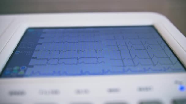 心臓科医は診療所の患者の心臓の心臓グラムの結果としてデジタルタブレットの画面を示しています — ストック動画