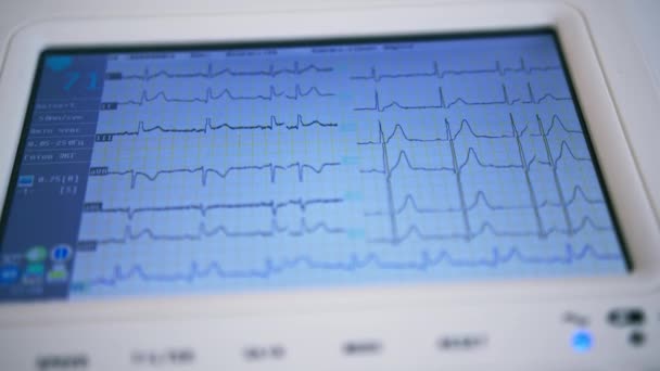 心臓科医は診療所の患者の心臓の心臓グラムの結果としてデジタルタブレットの画面を示しています — ストック動画