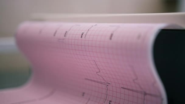 循環器内科医は患者の心電図を作成し患者の脈拍数と心拍の分析を診療所で印刷します — ストック動画