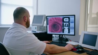 Hasta klinikte bilgisayar tomografisinden geçiyor, radyoloji uzmanı prosedürün gidişatını ve mide taramasının sonuçlarını izliyor.