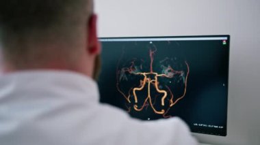 Hasta klinikte bilgisayar tomografisinden geçiyor, radyoloji uzmanı prosedürün gidişatını ve akciğer taramasının sonuçlarını izliyor.
