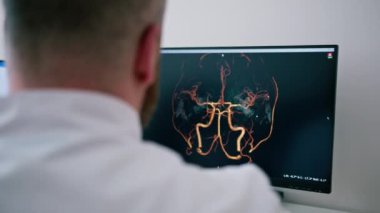 Hasta klinikte bilgisayar tomografisinden geçiyor, radyoloji uzmanı prosedürün gidişatını ve akciğer taramasının sonuçlarını izliyor.
