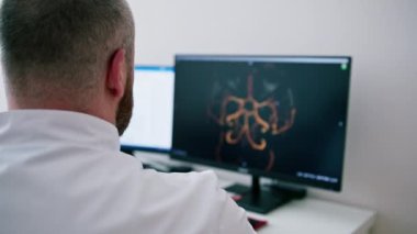 Hasta klinikte bilgisayar tomografisinden geçiyor, radyoloji uzmanı prosedürün gidişatını ve akciğer taramasının sonuçlarını izliyor.