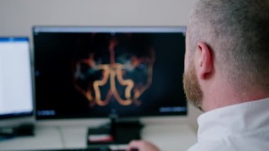 Hasta klinikte bilgisayar tomografisinden geçiyor, radyoloji uzmanı prosedürün gidişatını ve akciğer taramasının sonuçlarını izliyor.