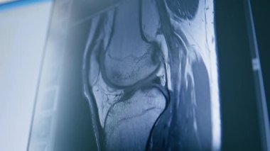 Bilgisayar tomografisi, beyin iltihabı kliniğinde görüntü oluşturma.