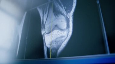Bilgisayar tomografisi, beyin iltihabı kliniğinde görüntü oluşturma.