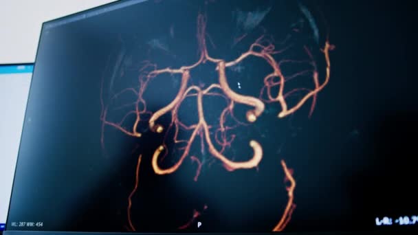 Paciente Submetido Tomografia Computadorizada Clínica Radiologista Acompanha Evolução Procedimento Resultados — Vídeo de Stock