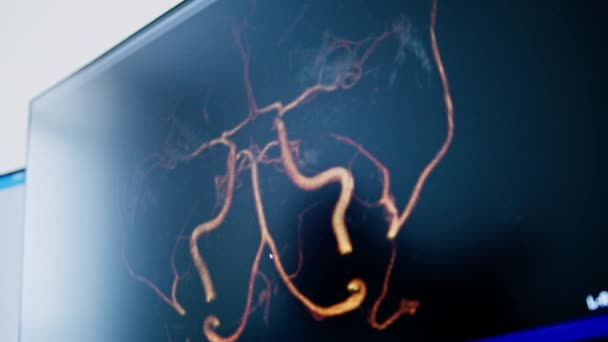 Pacjent Poddaje Się Tomografii Komputerowej Klinice Radiolog Monitoruje Przebieg Zabiegu — Wideo stockowe