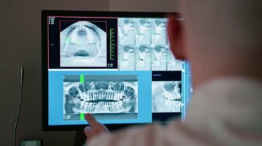 Diş sağlığı kliniğinin bilgisayar ekranında bir hastanın çenesinin röntgen görüntüsünün taranması