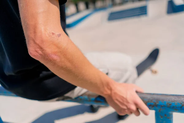 Detailní Záběr Ruku Skateboardisty Držícího Zábradlí Městském Skateparku Koncept Adrenalinové — Stock fotografie