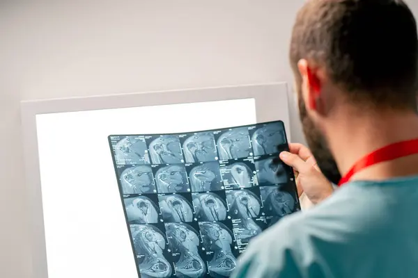 A close-up frame of an MRI image on a special board for an accurate and detailed a description of image and diagnosis