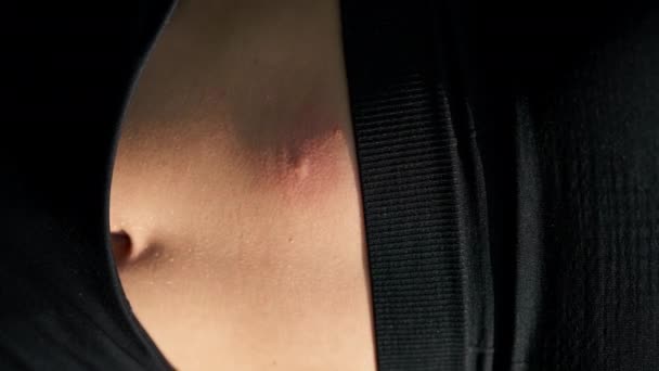 Vídeo Vertical Close Mão Uma Mulher Arranhando Picada Mosquito Grande — Vídeo de Stock