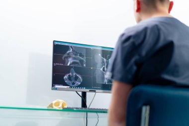 Radyoloji doktoru, klinikteki estetik ameliyatın sonuçlarını belirlemek için burun taramasının 3 boyutlu görüntüsünü gösteren bir ekrana bakar.