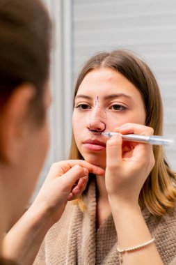 Yakın plan estetik cerrah burun ameliyatı öncesi konsültasyon sırasında hastanın yüzünde izler bırakır.