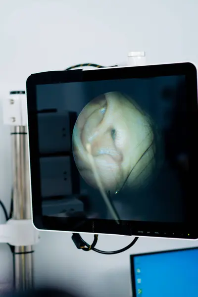 Kulak Kanalı Endoskopisi Prosedürüne Yakın Çekim Klinikteki Cihazın Ekranındaki Kulakların — Stok fotoğraf