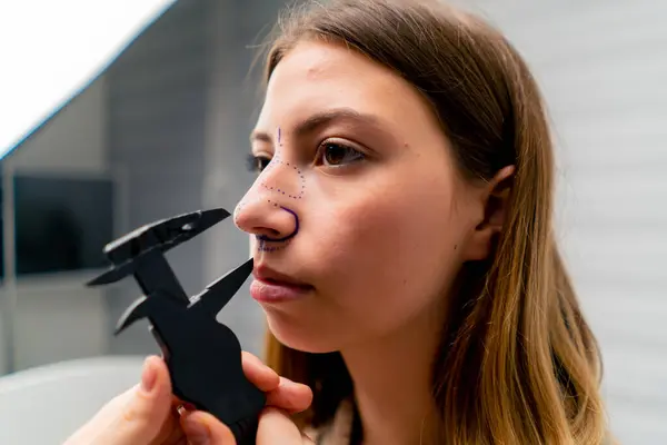 クローズアップドクターは 診療所の手術前に女性患者の鼻を測定するためのEnt器具を保持しています — ストック写真