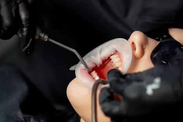 Vicino Uno Studio Dentistico Una Dentista Donna Con Berretto Pulisce — Foto Stock