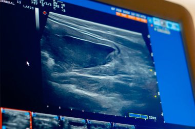 Bir veteriner kliniğinde karın ultrasonu monitöründe yakın plan görüntüleme.
