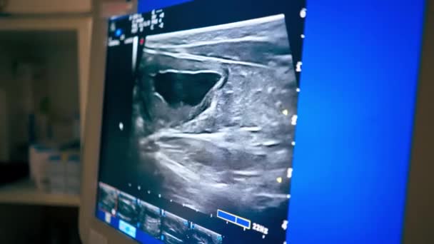 Close Een Veterinaire Kliniek Screening Een Abdominale Echografie Monitor — Stockvideo