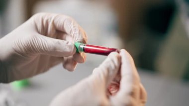 Bir veteriner kliniğinde yakın plan beyaz eldivenli bir doktor test tüpünde kan sallıyor.