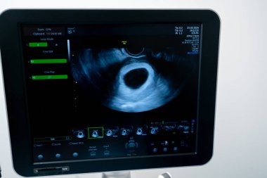 Jinekoloji muayenehanesine yakın çekim, hamilelik süresini gösteren bir tarama.