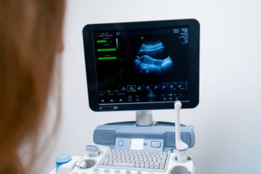 Bir klinikteki jinekoloji ofisinde doktorun biri hastanın küçük organlarının ultrasonunu çeker.