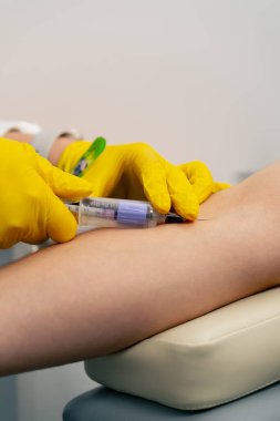Klinikte yakın plan sarı eldivenli bir doktor hastadan test için kan alır.