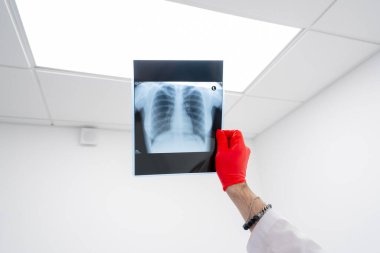 Özel bir klinikte, beyaz bir röntgen odasında doktor hastaya sırtının resmini gösterir.