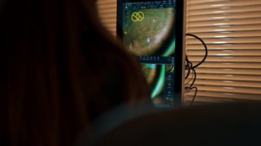 Bir göz hekiminde genç bir doktor büyüteç lazer düzeltmesi ile genç bir kıza teşhis koyuyor.