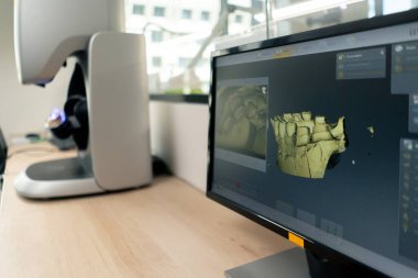 Dişçi protozoa kaplamaları ve kaplamaları üretmek için profesyonel bir laboratuvar. Tarama makinesinin diş izi 360 derecelik bir döngü profesyonel denetimi oluşturmak için.