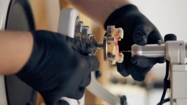 Dikey video, diş protezlerinin üretimi için profesyonel laboratuvarı kapatır ve kaplamaları taçlandırır. Bir uzman bir tacı insan çene kemiği profesyonel ekipman şekline getirir.