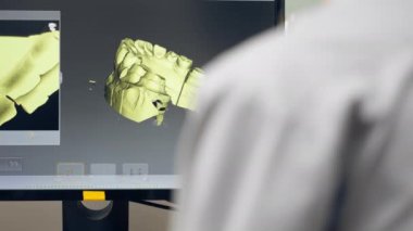 Diş protozoası kaplamaları ve kaplamaları üretmek için profesyonel laboratuarı kapatın. Bir tarama makinesi diş izi oluşturmak için 360 derece döngü profesyonel denetim